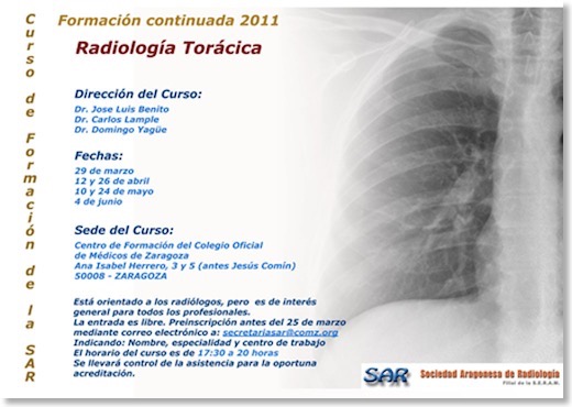 Curso1_TOR